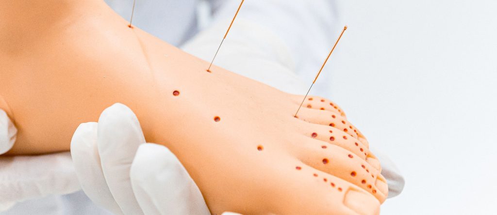 nanofibras-diabetes-cicatrizacion-contexto-udlap